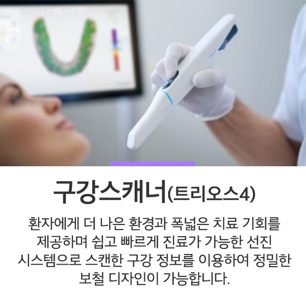 구강스캐너