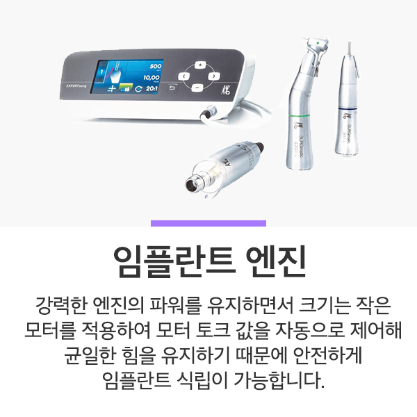 임플란트 엔진